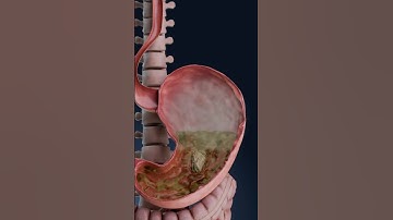Bloating 3D visualization: what’s happening in your body?
