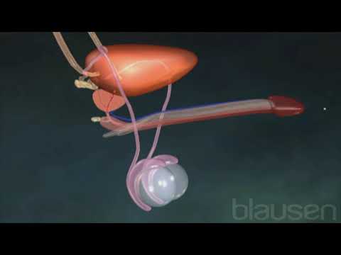 Video: Kan vasektomi reverseres?