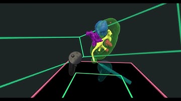 Urologic Oncology 3D Segmentation in Virtual Reality