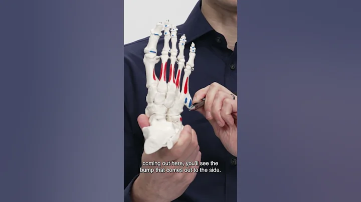 Could This Be The Cause Of Your Foot Pain?