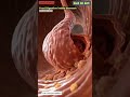 FOOD DIGESTION INSIDE THE STOMACH #digestivehealth #digestion #digestivesystem #payalnursingstudy