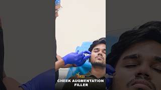 The Secret to Youthful Cheeks | Cheek Augmentation Filler #skincare #fillers #ytshorts #informclinic