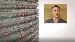 BioHorizons Tapered Pro can be used in multiple situations