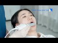Vídeo: Aoralscan Lync Escaner IntraOral