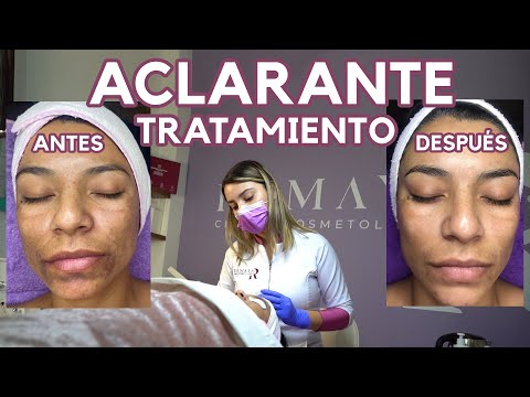 Video: Eliminación de manchas de ojos de diamante