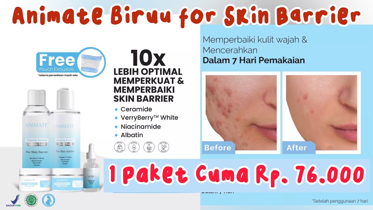 REVIEW ANIMATE SKINCARE BAGUS BANGET BUAT SKIN BARRIER YouTube