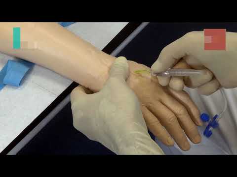 Video: Flebitis - Flebitis Na Injectie