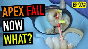 EP97# When You Can’t Get to Length: What I Do (Live Consent)