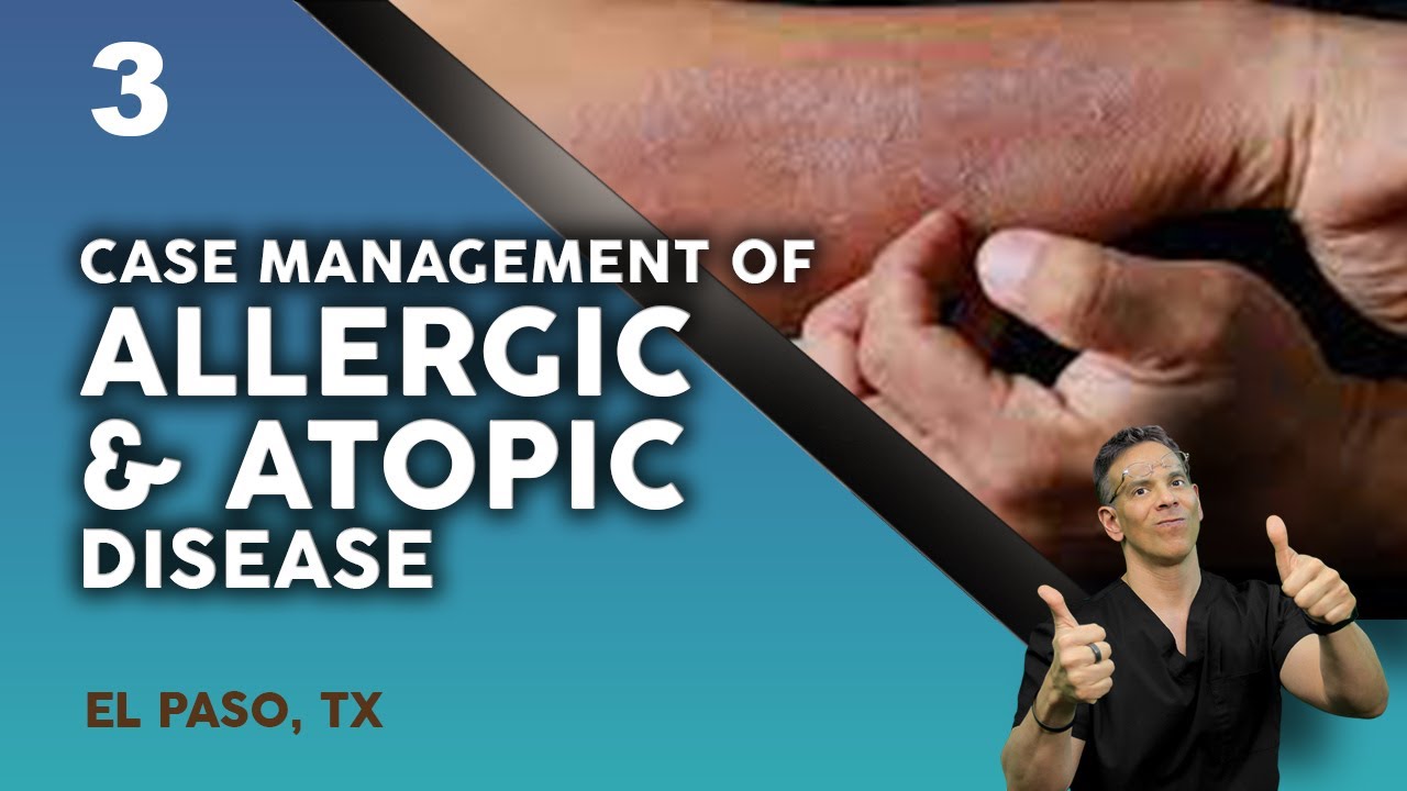 Allergic & Atopic Diseases | El Paso, Tx (2021) 3/3