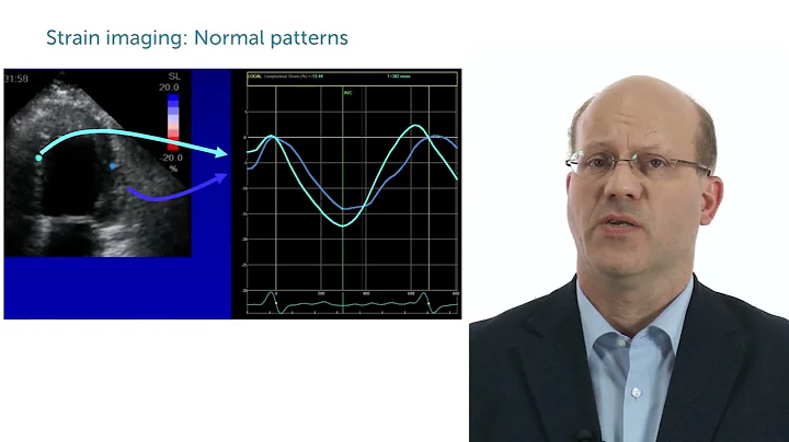 Case: Strange wall motion abnormality that is not an infarct