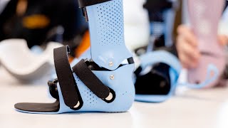 3D Printing in Orthotics: A New Era of Patient Care