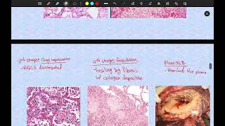 RS | Pathology LAB 1