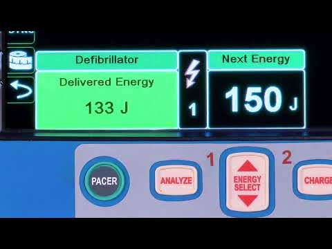 X Series® Advanced: Defibrillation (English)