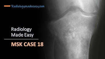 A 65 year old patient presented for 3 years duration | FRCR Radiology MSK case 18