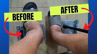 Best Exercises &amp; Remedies To Shrink Ankle Swelling