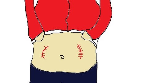 Masterfully Done (Surgeon Simulator)