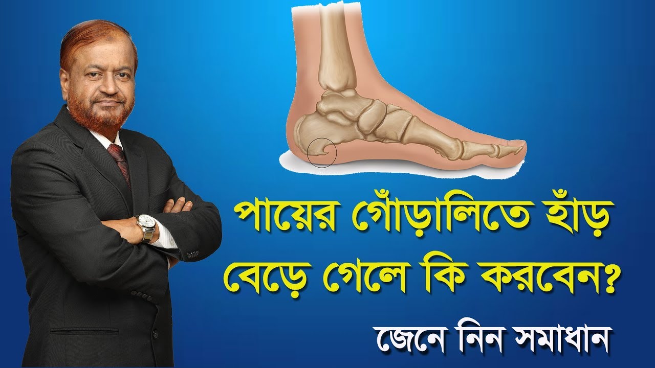 গোঁড়ালি ব্যথা/ heel pain/ Heel Spur treatment in Bengali YouTube