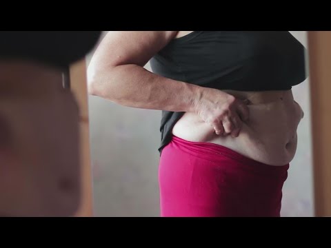 Does Losing Weight Increase Estrogen Level