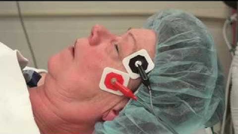 Monitoring Neuromuscular Function (2018)