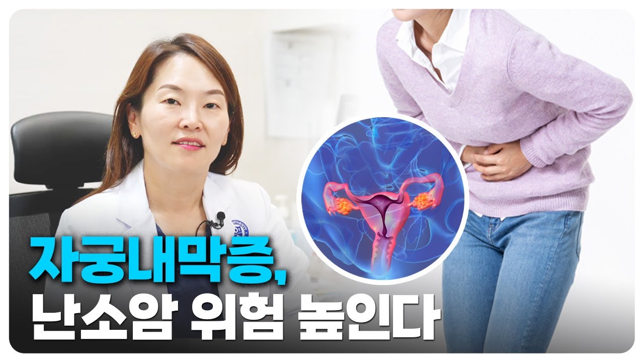 [닥튜브] 자궁내막증, 난소암 위험 높인다