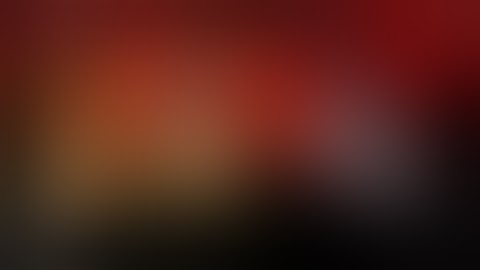 Immediate Loading full arch with digital impressions (Trios 2).