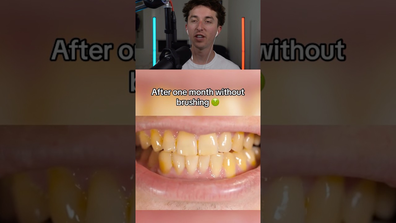 The Actual Problem With Not Brushing Your Teeth 🦷🤯