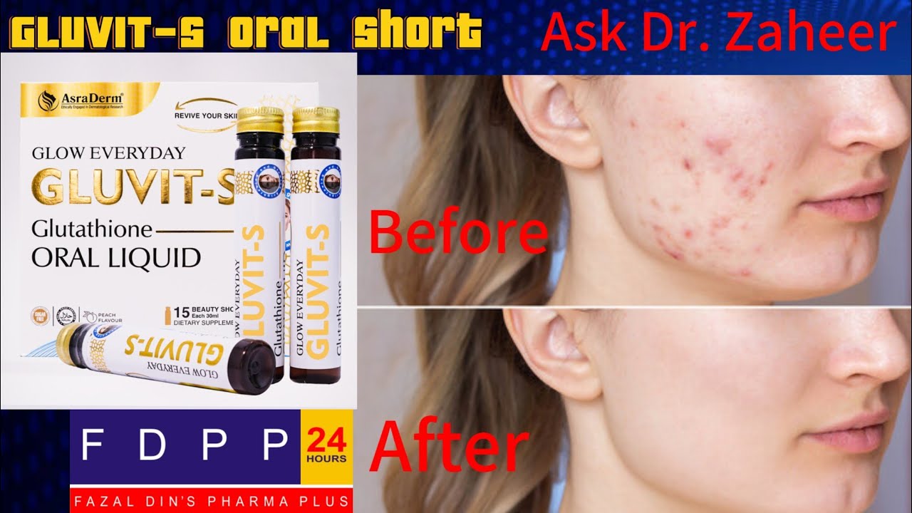 gluvit s glutathione oral liquid 𝐆𝐥𝐮𝐯𝐢𝐭-𝐒 𝐎𝐫𝐚𝐥 𝐋𝐢𝐪𝐮𝐢𝐝 𝐚𝐧𝐝 𝐁𝐫𝐢𝐠𝐡𝐭𝐞𝐧𝐢𝐧𝐠  𝐒𝐞𝐫𝐮𝐦 𝐨𝐟𝐟𝐞𝐫 𝐬𝐞𝐯𝐞𝐫𝐚𝐥 𝐬𝐤𝐢𝐧 𝐛𝐞𝐧𝐞𝐟𝐢𝐭𝐬:,  ✨𝐇𝐞𝐥𝐩𝐬 𝐩𝐫𝐞𝐯𝐞𝐧𝐭 𝐰𝐫𝐢𝐧𝐤𝐥𝐞𝐬 𝐚𝐧𝐝 𝐟𝐢𝐧𝐞 𝐥𝐢𝐧𝐞𝐬 ,  🌟𝐑𝐞𝐝𝐮𝐜𝐞𝐬 𝐚𝐠𝐞 𝐬𝐩𝐨𝐭𝐬 𝐚𝐧𝐝 𝐚𝐜𝐧𝐞 𝐬𝐜𝐚𝐫𝐬 ,  🌼𝐌𝐢𝐧𝐢𝐦𝐢𝐳𝐞𝐬 𝐛𝐥𝐞𝐦𝐢𝐬𝐡𝐞𝐬 𝐚𝐧𝐝 𝐞𝐯𝐞𝐧𝐬 𝐬𝐤𝐢𝐧 𝐭𝐨𝐧𝐞  ,