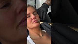 Kerry Katona heads for a lip filler top up