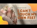 I Can't Touch My Own Feet:  Serious Fungal Toenails (Hip Arthritis)
