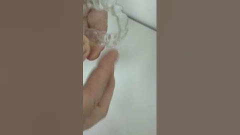 3Dresyns 3D printed aligner with 3Dresyn OD-Clear TF LTP (by 3Dresyns) with a low cost LCD printer