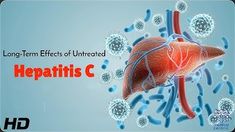 Untreated Hepatitis C: How It Affects Your Liver and Overall Health