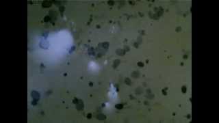 Potato seen in Microscope