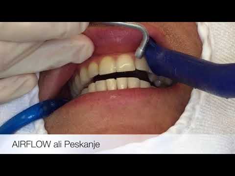 Video: Zobje - Struktura, Delovanje, Zdravljenje, Odstranjevanje, Beljenje