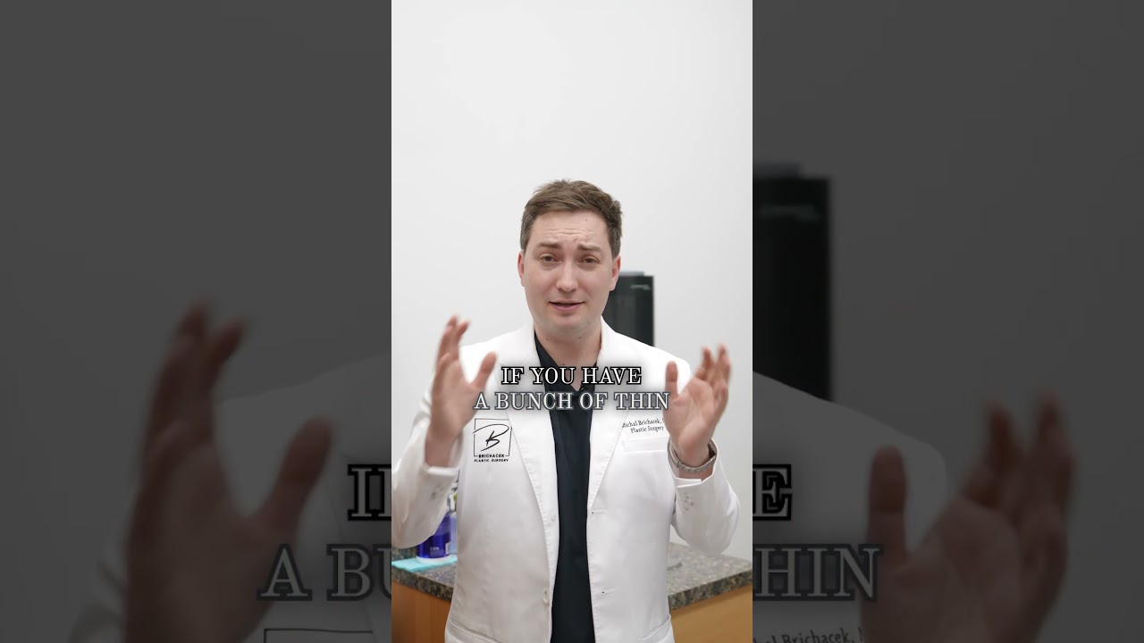 How Many Grafts Do You Need For A Hair Transplant?