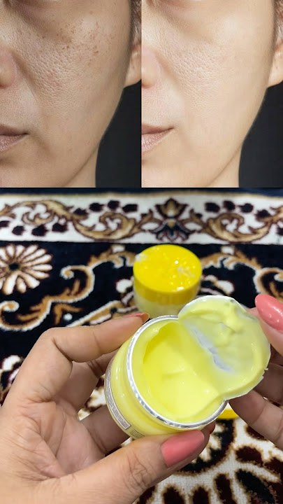 Turmeric & Vitamin C Face Cream | Skin Whitening, Anti-Aging & Acne Care ​⁠