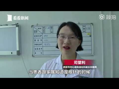 视频：老妇喝汤误吞4厘米绣花针 