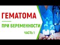 Гематома при беременности. Чего стоит опасаться?