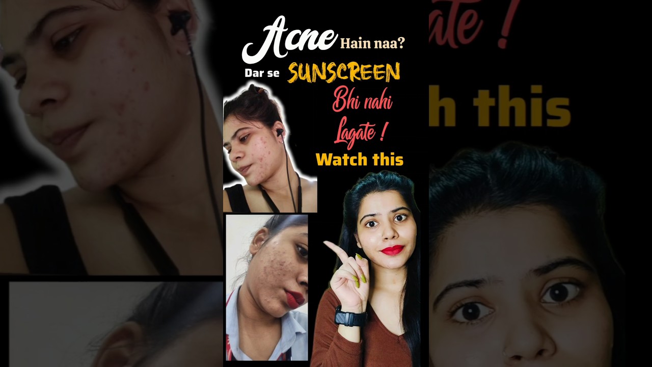 What! Not Using Sunscreen Due To Acne ? 😨 Watch This 👇 
