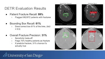 AAI-590 Capstone - Cervical Spine Fracture Detection Using Computer Vision