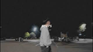 scars - keenan te // speed up