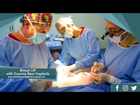Видео: Gummy Bear Implants: плюсове и минуси, цена, предпазни мерки