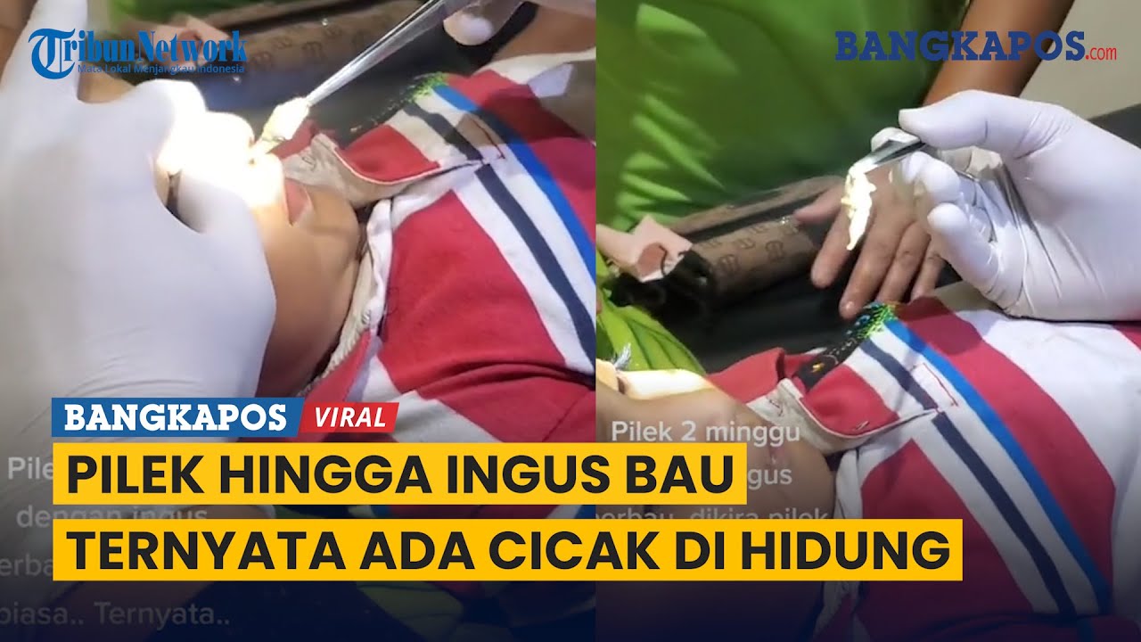 Bocah ini Pilek Selama 2 Minggu Hingga Ingus Bau, Ternyata Ada Cicak