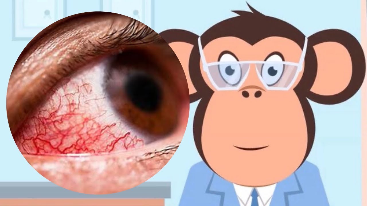 10 Shocking Ways to Prevent Visual Problems! You Won't Believe #7 ...