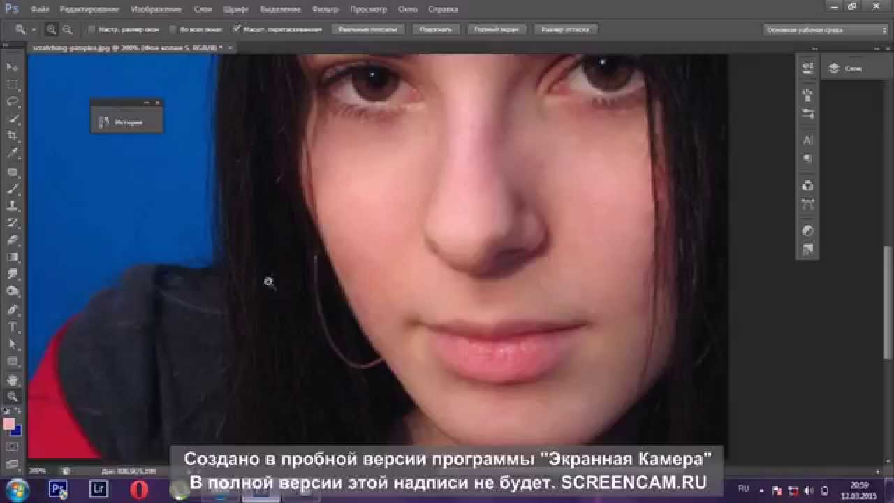 Удаление дефектов кожи-прыщи,веснушки,черные точки,блеск под глазами ...