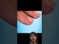 Why You Shouldn’t Peel Your Hangnails 😖 #nails#reaction #knowledge #reels