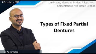 Prostho-FPD | Laminates, Maryland Bridge, Allceramics, Cementations & Tissue Dilation | Types of FPD