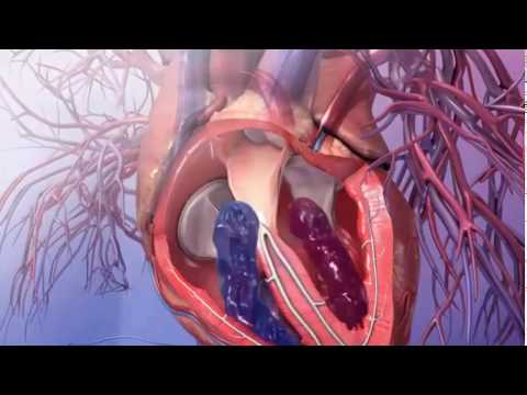 Видео: Где в сердце расположены полулунные клапаны?