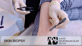 Skin Biopsy at Austin Neuromuscular Center (Austin, Texas)