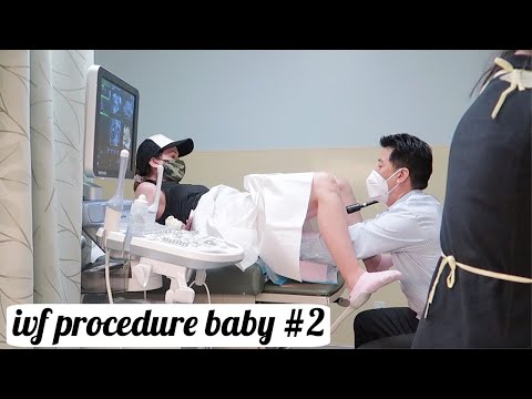 IVF procedure baby #2 (Saline Infusion Sonohysterogram)