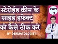 Steroid Creams Side Effects Treatment In Hindi । स्टेरोईड क्रीम्स के साइड इफ़ेक्ट्स को कैसे ठीक करे